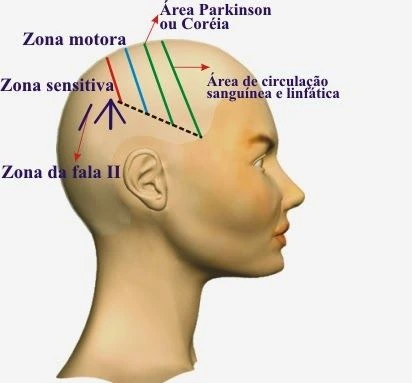 Ilustração lateral da cabeça com regiões do modelo de craniopuntura chinesa.
